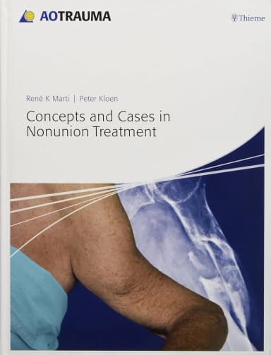 Image of - Concepts and Cases in Nonunion Treatment