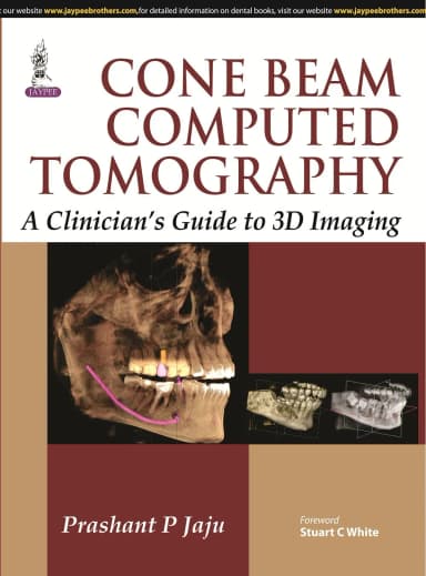 Image of - Cone Beam Computed Tomography: A Clinician’s Guide to 3D Imaging - 1st Edition 2015