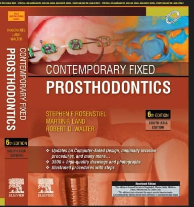 Image of - Contemporary Fixed Prosthodontics (SAE) -6E