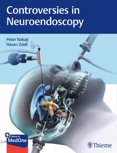 Image of - Controversies in Neuroendoscopy 1st Ed.