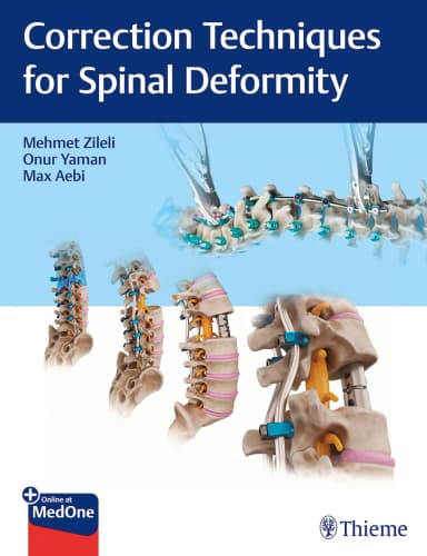 Image of - Correction Technoques for Spine Deformoty 1st Ed.