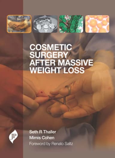 Image of - Cosmetic Surgery after Massive Weight Loss