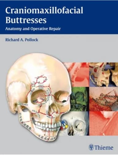 Image of - Craniomaxillofacial Buttresses - 1st Edition
