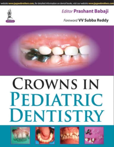 Image of - Crowns In Pediatric Dentistry - 1st Edition