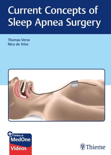 Image of - Current Concepts of Sleep Apnea Surgery 1st Ed.