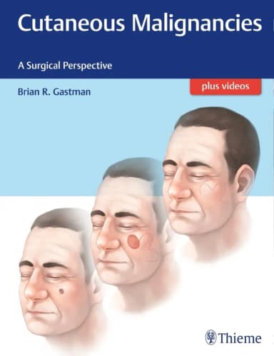 Image of - Cutaneous Malignancies A Surgical Perspective 1st Edition