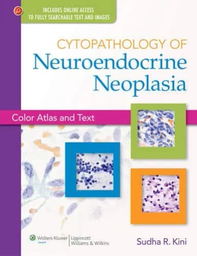 Image of - Cytopathology of Neuroendocrine Neoplasia
