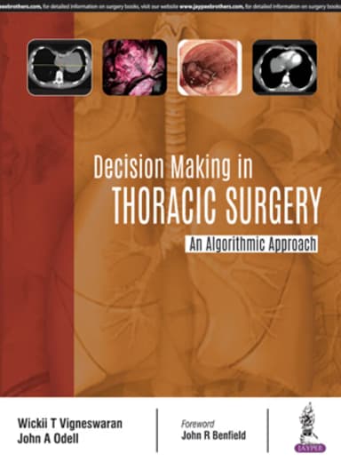 Image of - Decision Making in Thoracic Surgery | An Algorithmic Approach