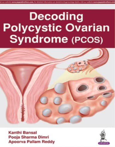 Image of - Decoding Polycystic Ovarian Syndrome | PCOS | - 1st Edition