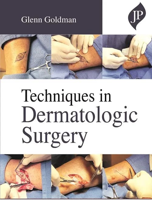Techniques in Dermatologic Surgery - 1st Edition