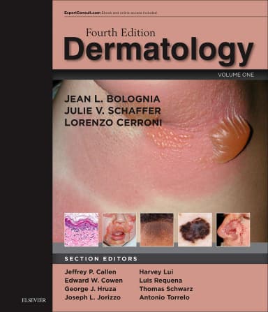 Image of - Dermatology 2-Volume Set - 5th Edition
