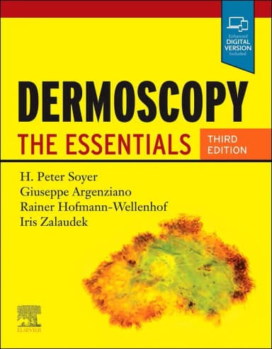 Image of - Dermoscopy The Essentials - Third Edition