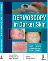 Image of - DERMOSCOPY IN DARKER SKIN