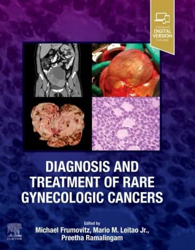 Image of - Diagnosis and Treatment of Rare Gynecologic Cancers - 1E