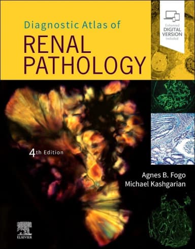 Image of - Diagnostic Atlas of Renal Pathology - 4E