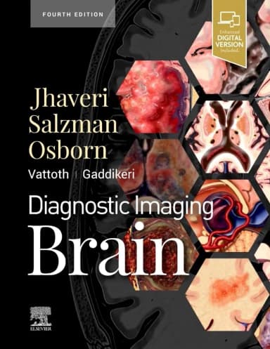 Image of - Diagnostic Imaging: Brain-4ED