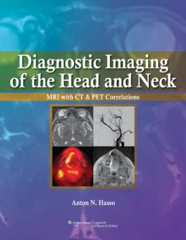 Image of - Diagnostic Imaging of the Head and Neck