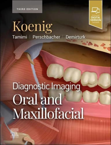 Image of - Diagnostic Imaging: Oral and Maxillofacial-3E