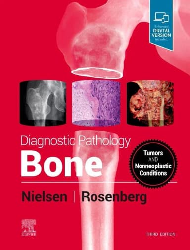 Image of - Diagnostic Pathology: Bone-3ED