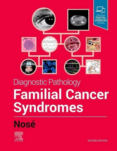 Image of - Diagnostic Pathology: Familial Cancer Syndromes - 2E