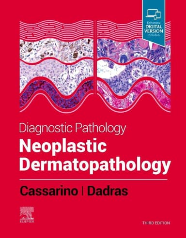 Image of - Diagnostic Pathology: Neoplastic Dermatopathology-3ED