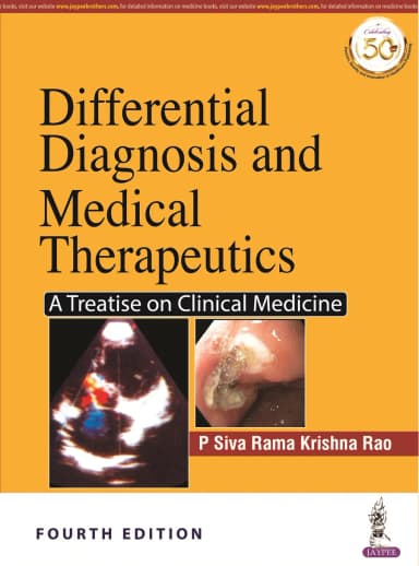Image of - Differential Diagnosis and Medical Therapeutics | A Treatise on Clinical Medicine