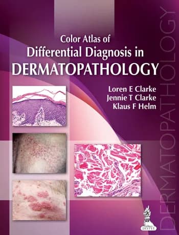 Color Atlas of Differential Diagnosis In Dermatopathology - 1st Edition