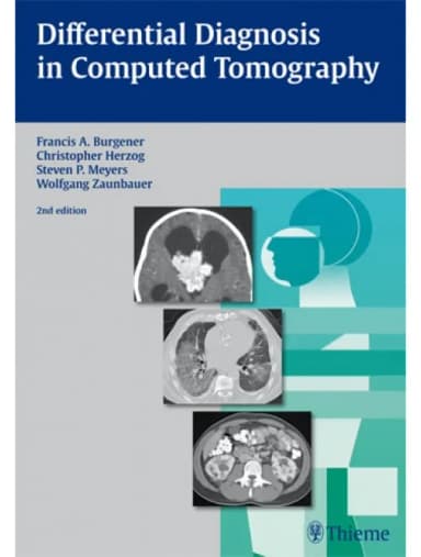Image of - Differential Diagnosis In Computed Tomography - 2nd Edition