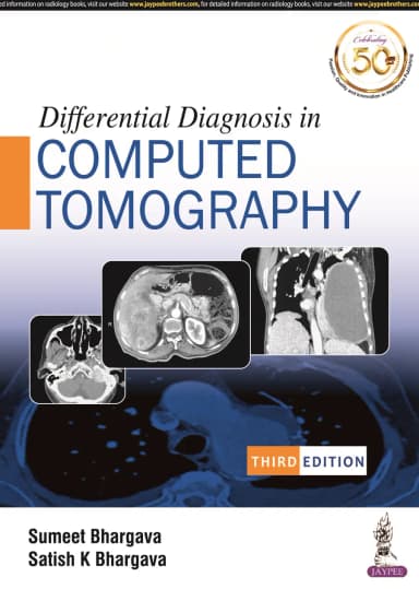 Image of - Differential Diagnosis in Computed Tomography