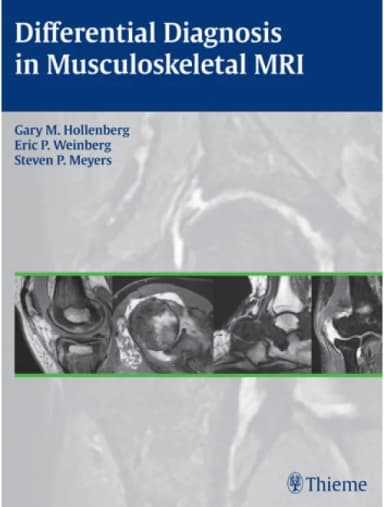 Thumbnail - Differential Diagnosis in Musculoskeletal MRI - 1st Edition