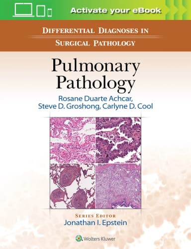 Image of - Differential Diagnosis in Surgical Pathology: Pulmonary Pathology - 1st Edition