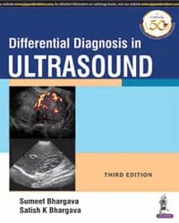 Image of - DIFFERENTIAL DIAGNOSIS IN ULTRASOUND