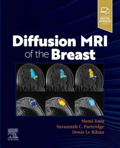 Image of - Diffusion MRI of the Breast - 1E