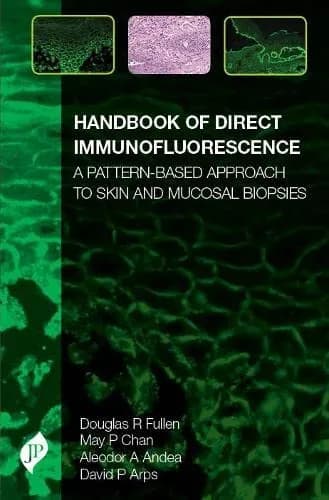 Image of - Handbook of Direct Immunofluorescence Pattern based Approach to Skin and Mucosal Biopsies - 1st Edition