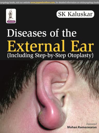 Image of - Diseases of the External Ear (Including Step-by-Step Otoplasty) - 1st Edition 2014