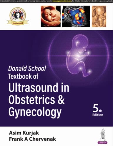 Image of - Donald School Textbook Of Ultrasound in Obstetrics & Gynecology