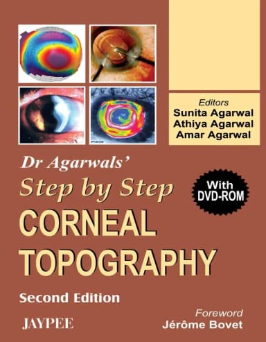 Image of - Dr. Agarwals Step by Step Corneal Topography with Dvd-rom - 2nd Edition