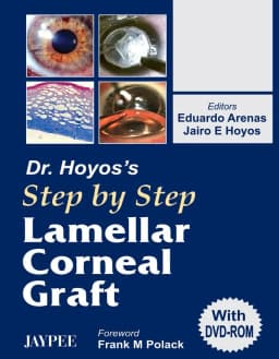 dr-hoyos-lamellar-corneal-graft-1st-edition