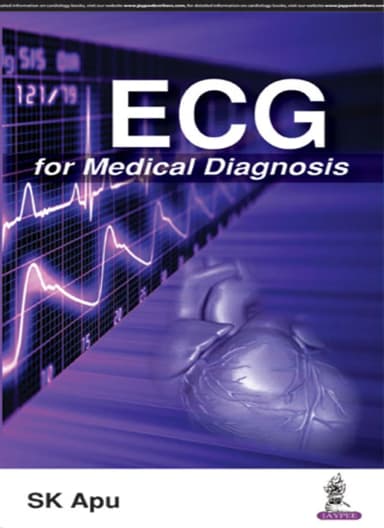 Image of - ECG for Medical Diagnosis
