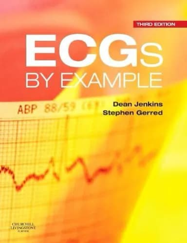 Image of - ECGs by Example - Third Edition