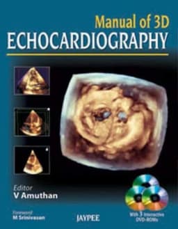 echocardiography-3d-manual-1st-edition
