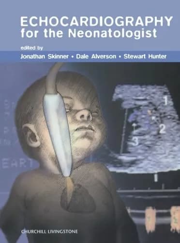 Thumbnail - Echocardiography for the Neonatologist-1E