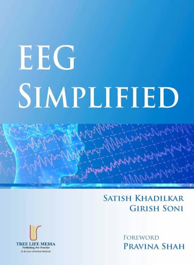 Image of - EEG Simplified -1E