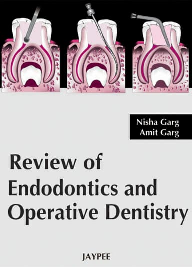 Image of - Review Of Endodontics And Operative Dentistry - 1st Edition