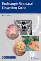 Image of - Endoscopic Sinonasal Dissection Guide - 1st Edition