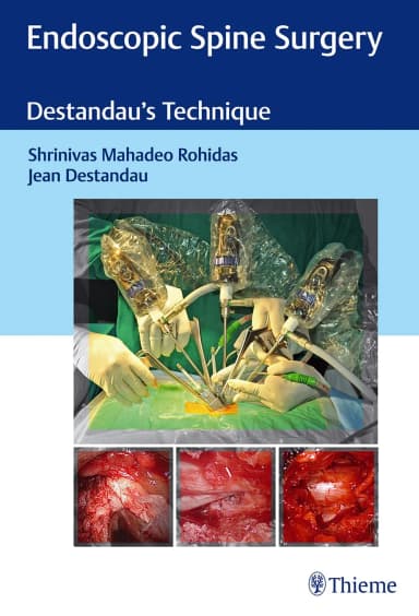 Image of - Endoscopic Spine Surgery 1st Edition