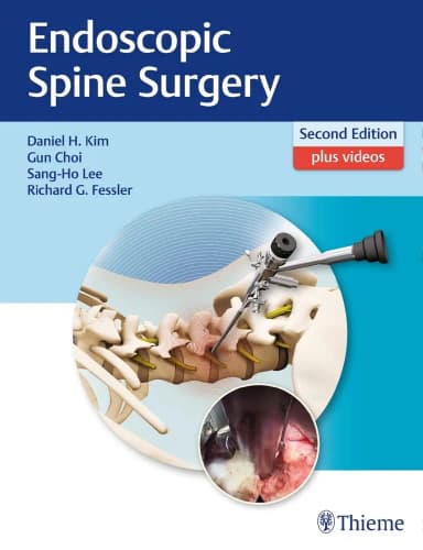 Image of - Endoscopic Spine Surgery 2nd Edition