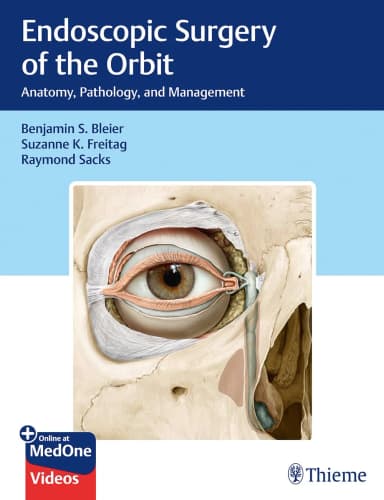 Image of - Endoscopic Surgery of the Orbit 1st Ed.