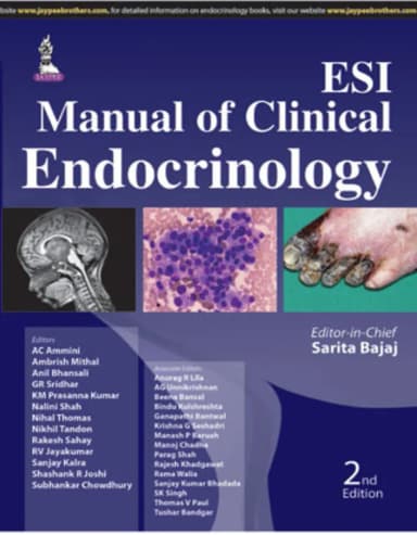 Image of - Esi Manual Of Clinical Endocrinology - 2nd Edition