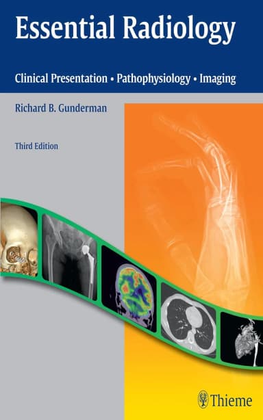 Image of - Essential Radiology Clinical Presentation · Pathop